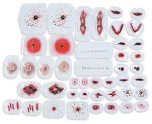 Ecchymosis < simulaids #717 