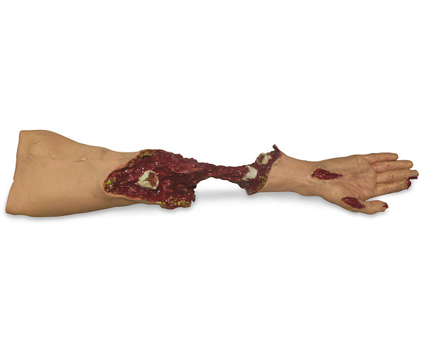 Xtreme Trauma Moulage Arm < simulaids #642 