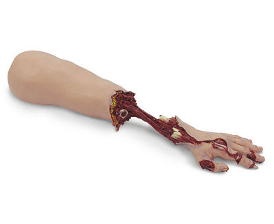 Ss Xtreme Trauma Bleeding Arm < simulaids #481 