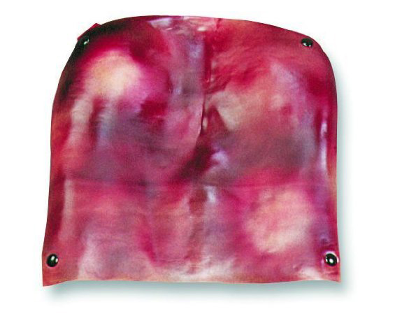 Casualty & Moulage 2nd & 3rd Degree Burns, Back < simulaids #6773 
