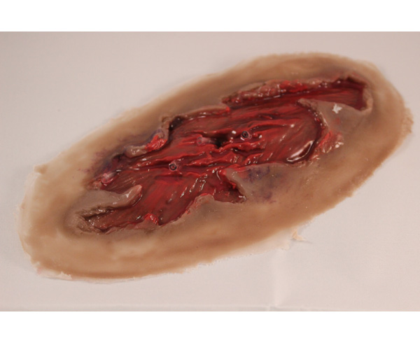 Mutliated Muscle/Dynamic (4) < #TMK-EPS-10-01-04-NT 
