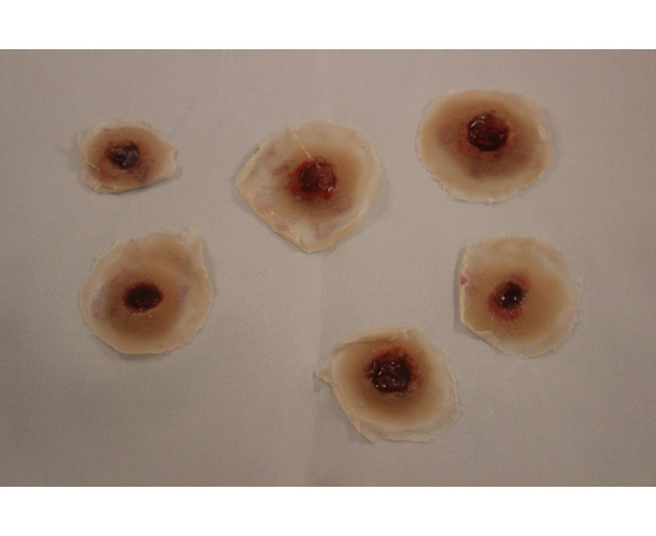 Entrance Wound (1) < #TMK-EPS-01-01-01 
