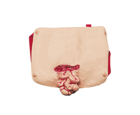 Abdominal W/Protruding Intest < simulaids #6808 