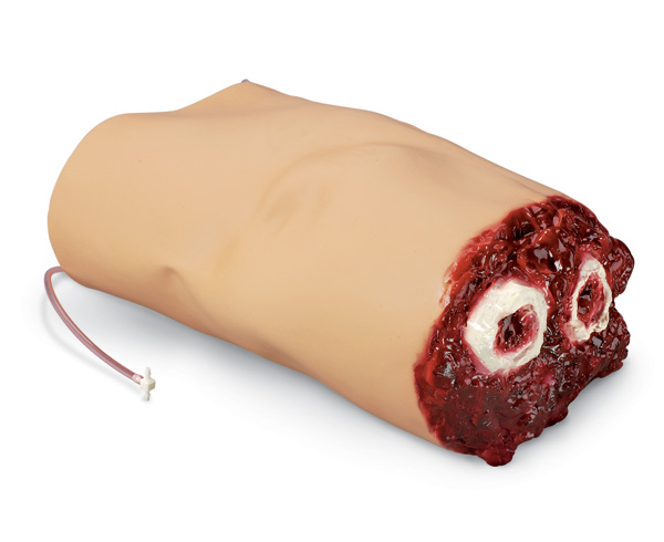 SMART STAT Patient Simulator Manikin Amputated Arm < simulaids #468 