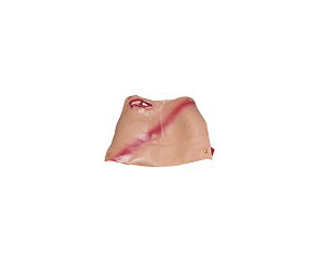 Casualty & Moulage Broken Clavicle w/ Contusion < simulaids #6727 