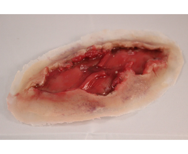 Muscle Torn Tendon/Non-Dynamic (12) < #TMK-EPS-05-01-12 