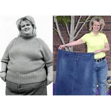 Kim Olsen Before & After