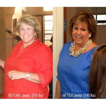Before and After