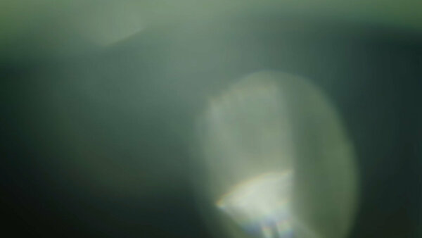 Dissolve: Lens Flare Transitions Dissolve 40 vfx asset stock footage