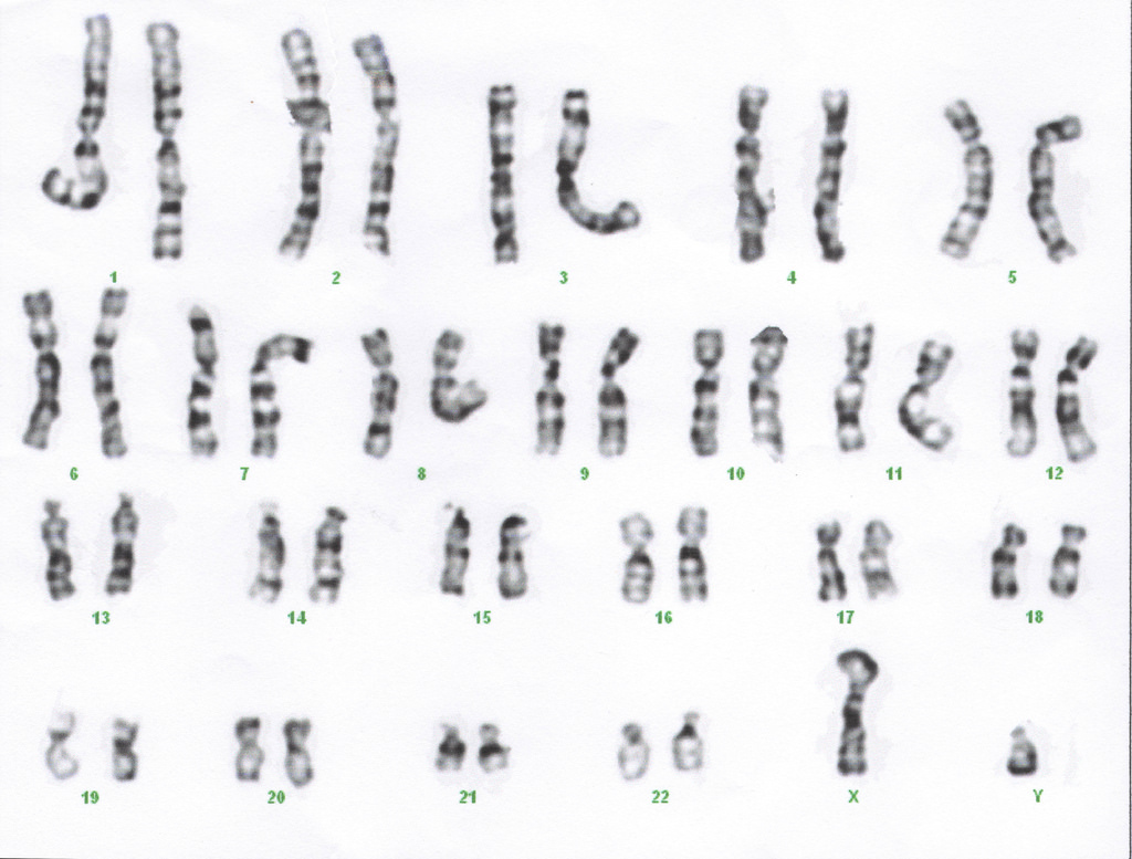 What is a karyotype?