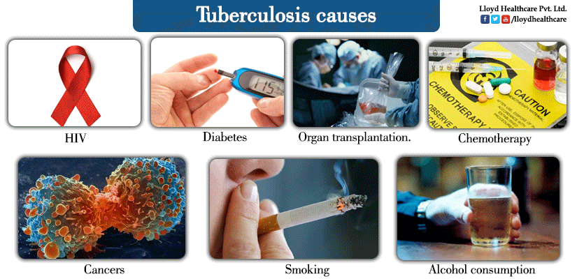 Tubercolusis By Yuehan Tuazon Infographic