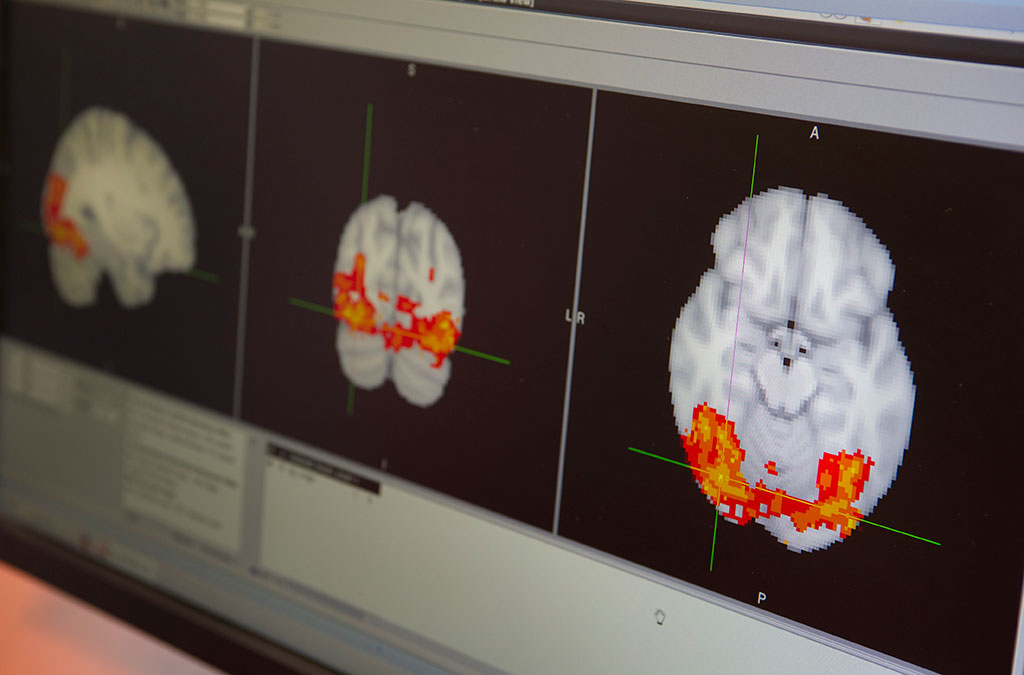 Food_Brain_Research_20141112_11