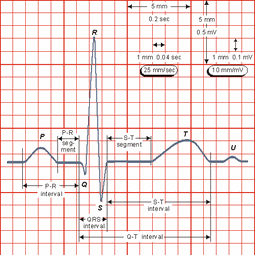 Canine ECG