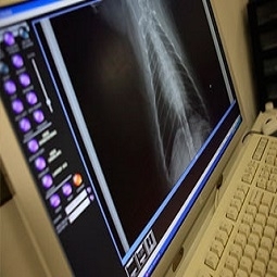 xrays picture march 2014