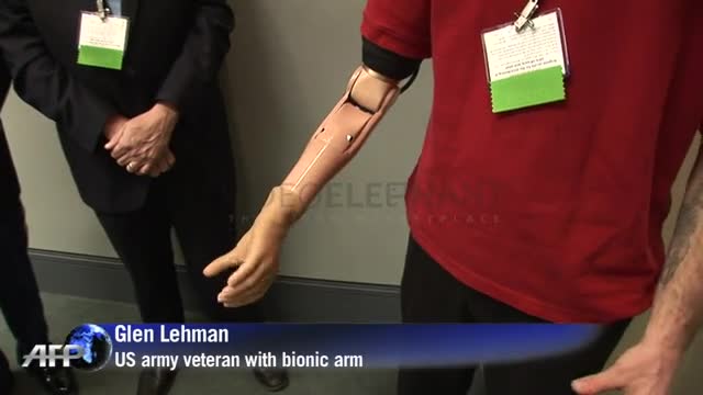 Mind-moved bionic arm helps vet use hand again
