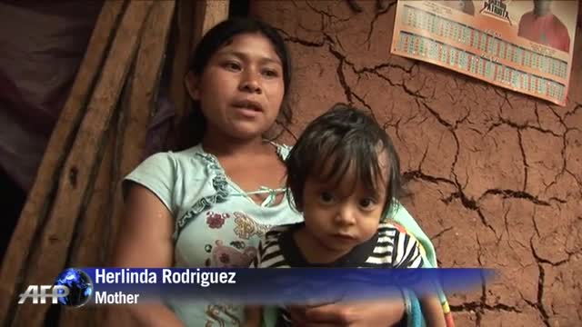 Guatemala's children endangered by malnutrition