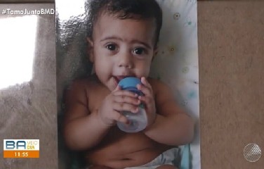 Criança não consegue enxergar, falar e tem dificuldades para comer.