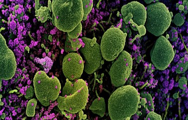 No total, 14 crianças e adolescentes entre 2 e 16 anos foram confirmados com a doença no estado