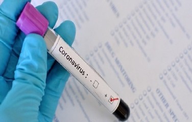 Segundo boletim, no total, país tem 5.730.361 contaminações em decorrência da doença