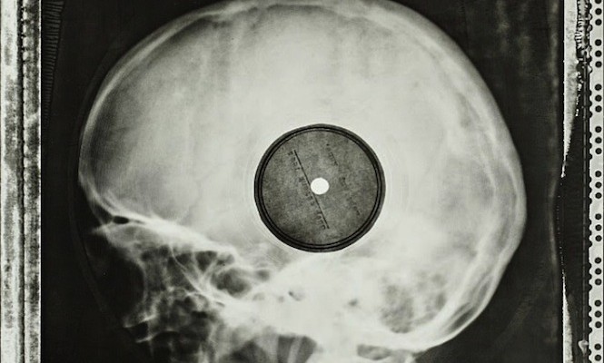incredible-images-of-soviet-era-bootleg-records-pressed-on-discarded-x-rays