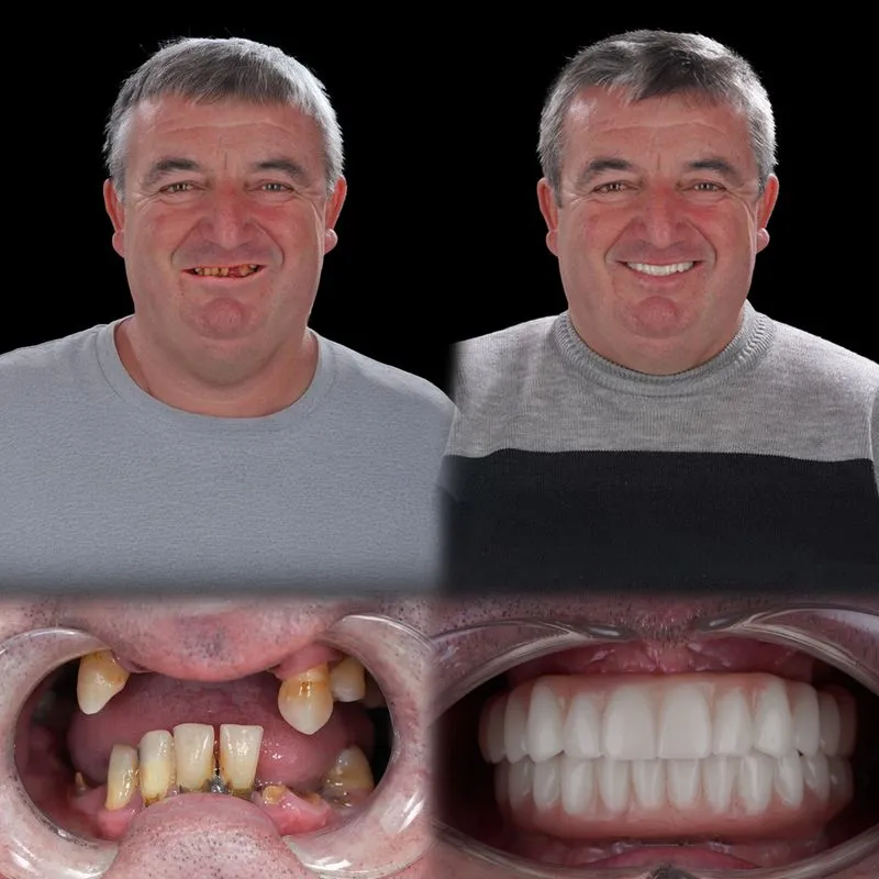 Rezultat pacient before/after