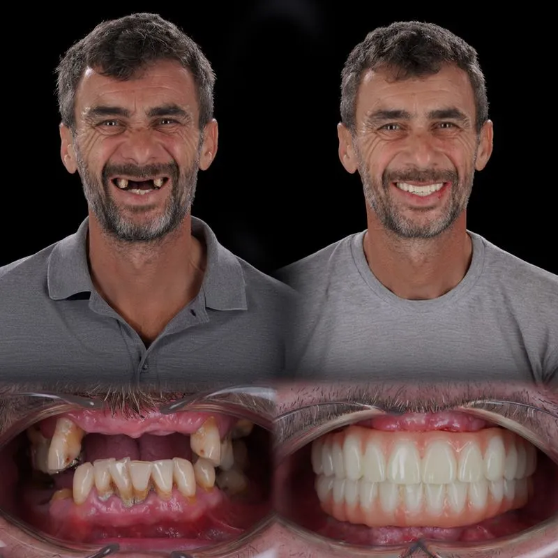 Rezultat pacient before/after