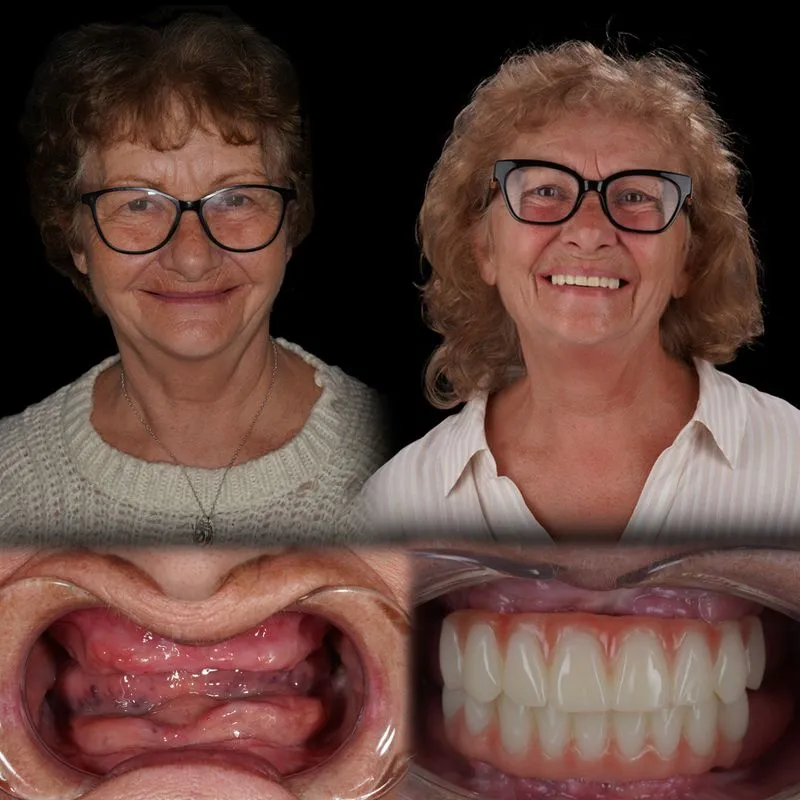 Rezultat pacient before/after