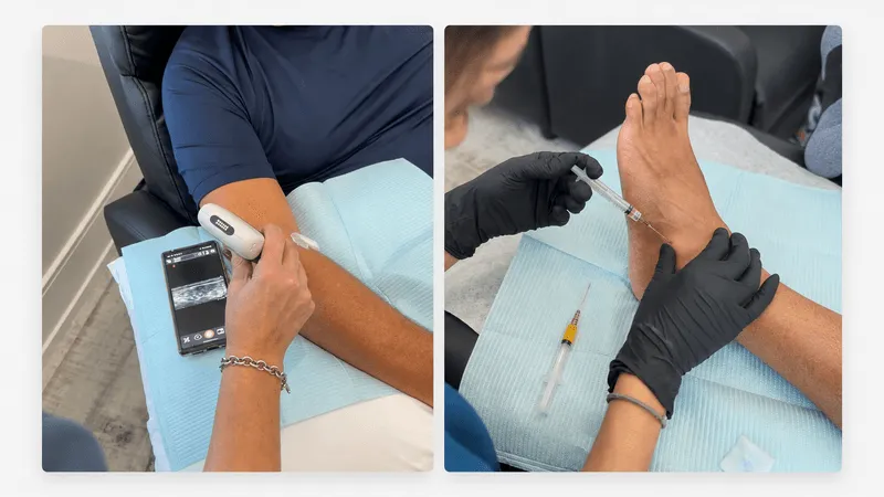 Ultrasound-guided injection at MedCAiRE
