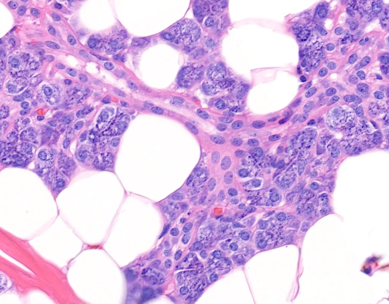 This section shows numerous serous acini with dark-staining cytoplasm, together with an intercalated duct characterized by a narrow lumen.
