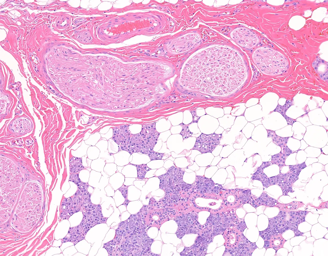 This example of the parotid gland shows thick nerve bundles and blood vessels traversing the glandular stroma.