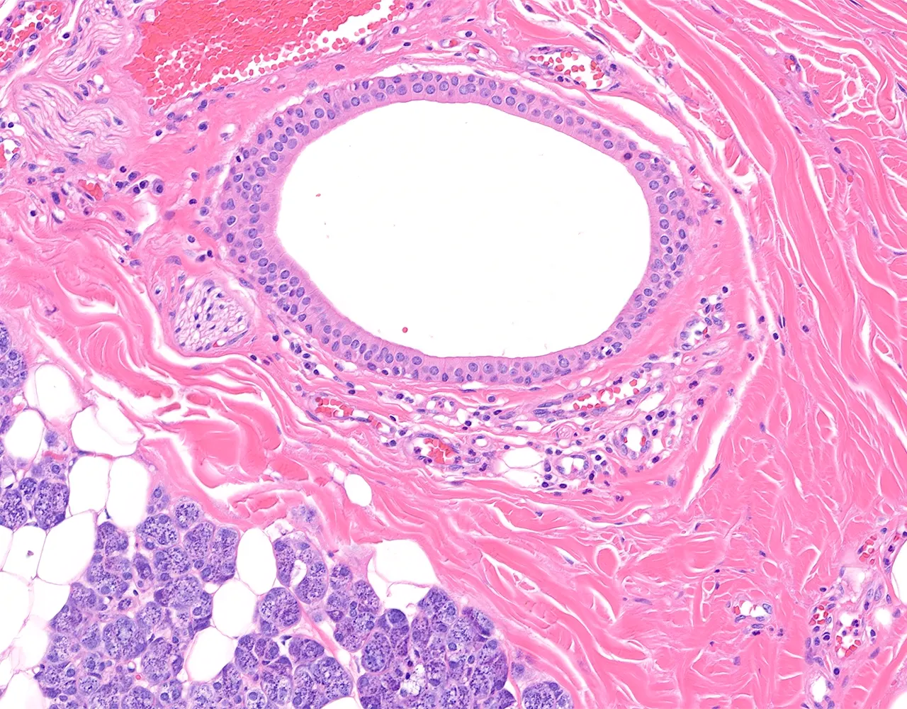 This example shows a large-caliber interlobular duct lined by pseudostratified epithelium.