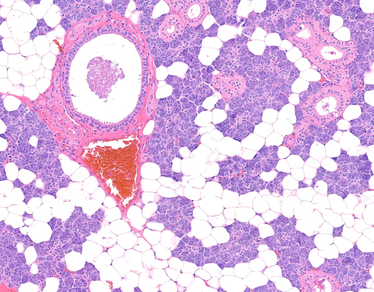 The parotid gland is composed almost entirely of serous acini. Multiple striated ducts and larger interlobular ducts are visible in this section.