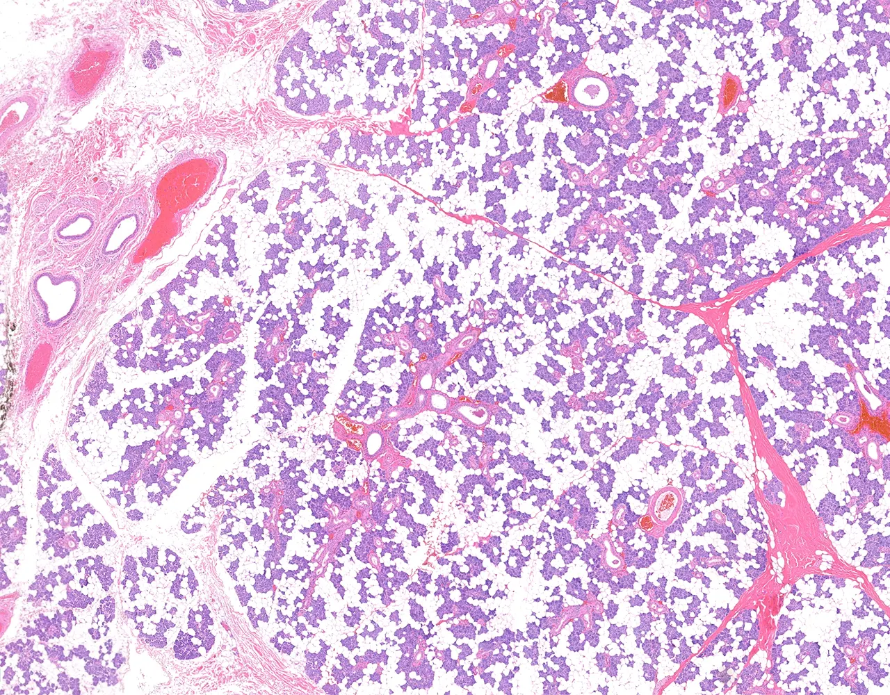 At low magnification, the parotid gland is composed of serous acini and ducts intermingled with abundant adipose tissue, separated by multiple fibrous septa.