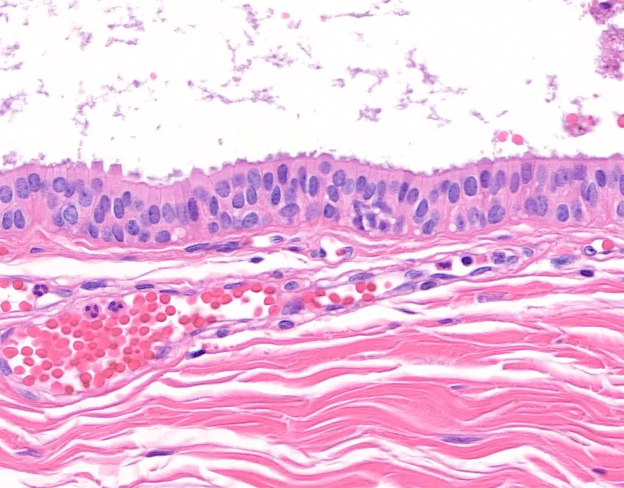 Large interlobular ducts are lined by tall epithelial cells with round to elongated nuclei and eosinophilic cytoplasm.