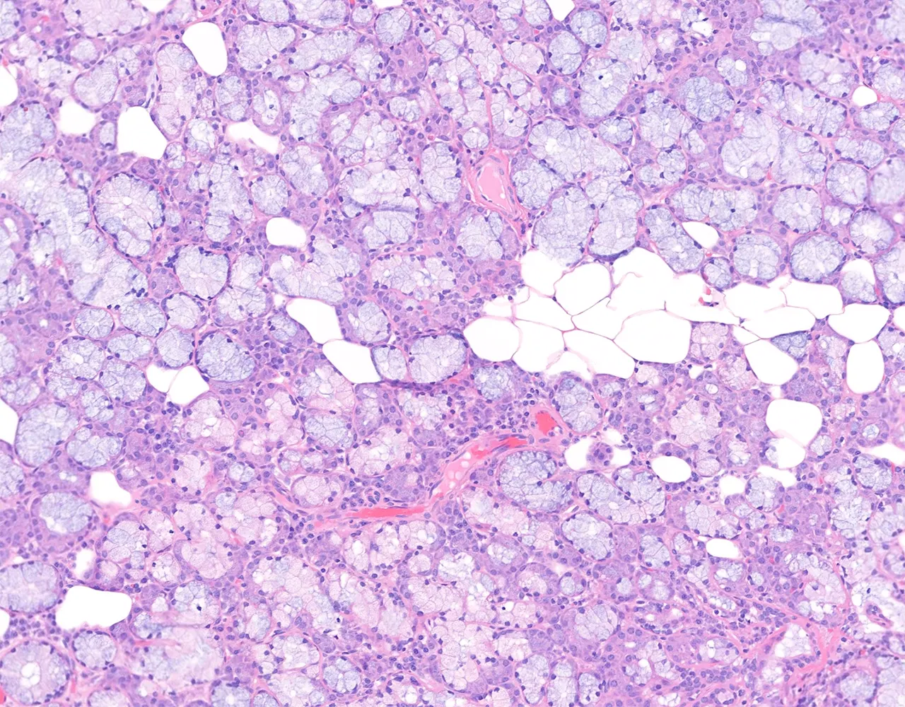 At higher magnification, the gland shows pale mucous acini and darker serous acini. The sublingual gland is predominantly mucous, with mixed acini showing serous demilunes.