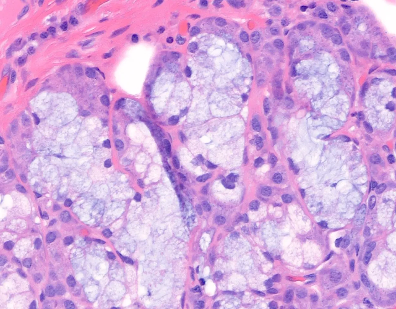 In mixed acini, serous cells may form crescent-shaped caps at the periphery of mucous acini, known as serous demilunes.