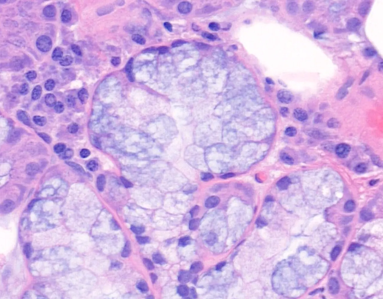 The acini are surrounded by a thin layer of contractile myoepithelial cells, which help expel secretions into the ductal system.