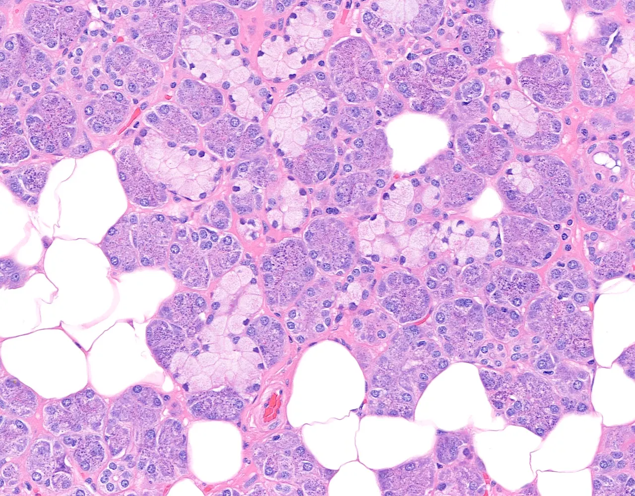 The submandibular gland is a mixed seromucous gland, composed of both serous and mucous components, with predominance of serous acini.