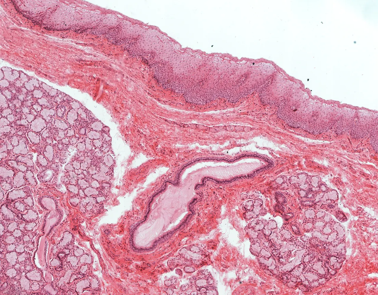 This section shows the buccal squamous mucosa overlying the sublingual gland. A large excretory duct is visible and courses toward the mucosal surface.