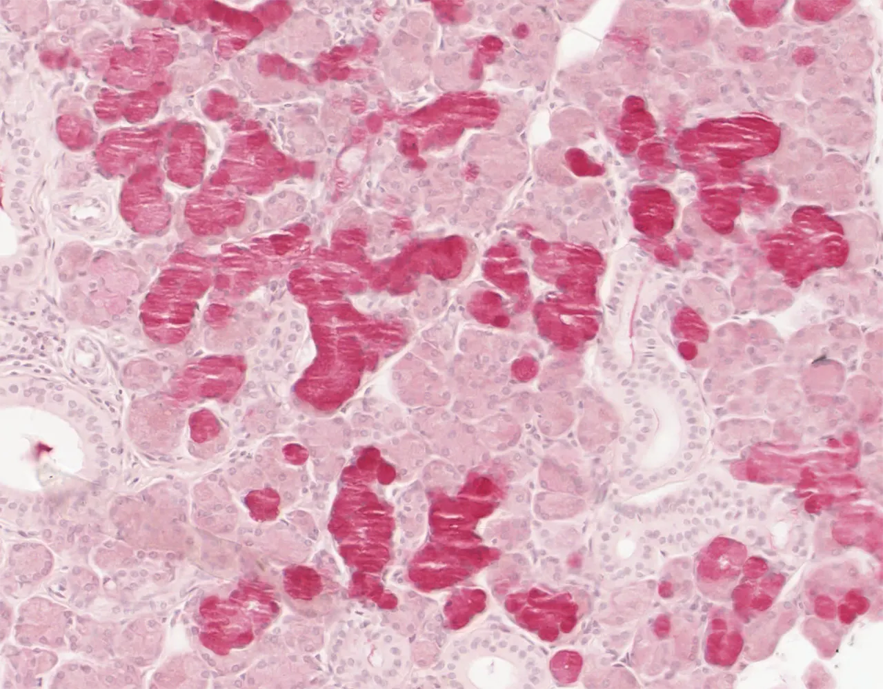 The mucicarmine stain highlights mucous cells within the seromucous units, emphasizing their tubular architecture, in contrast to the more rounded appearance of serous acini.