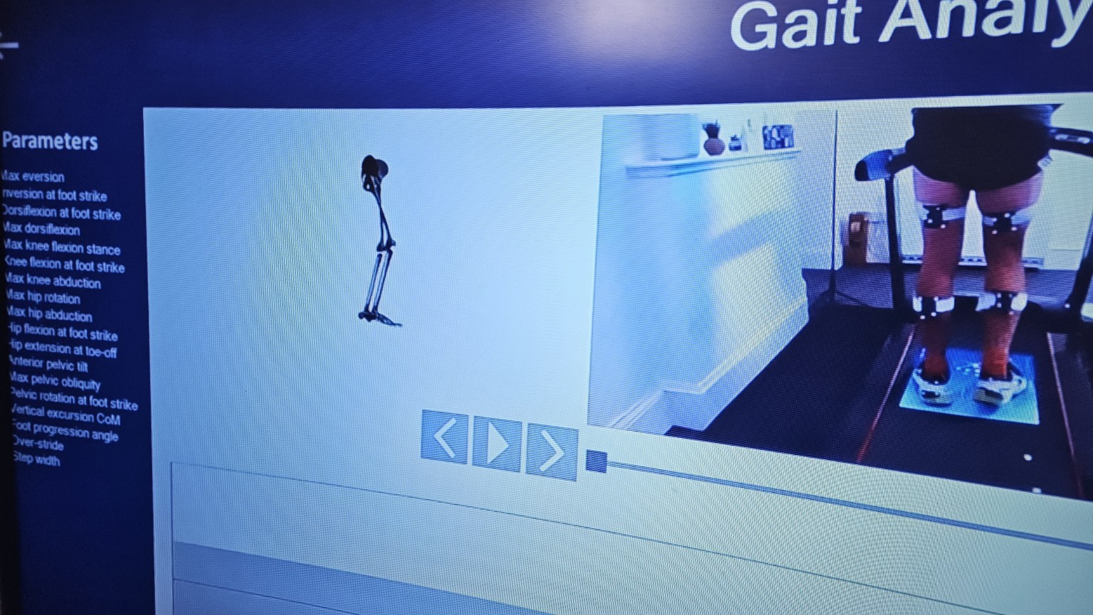 Running and gait assessment at Steps Podiatry & Gait