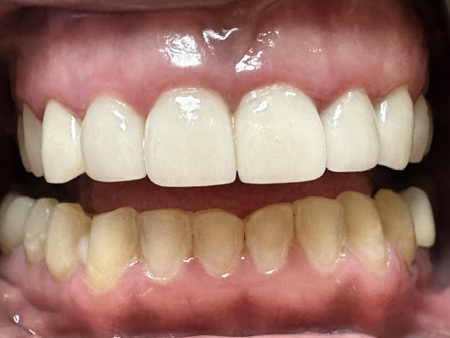 Case 2: after dental treatment