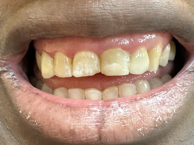 Case 2: before dental treatment