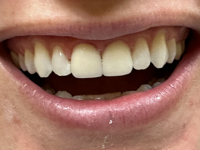 Case 4: after dental treatment