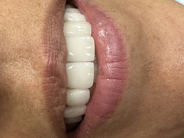 Case 6: after dental treatment