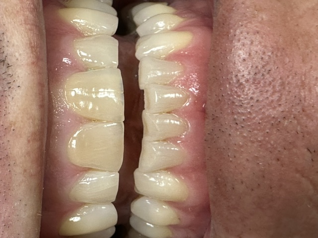 Case 5: before dental treatment