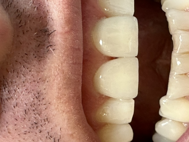Case 5: after dental treatment