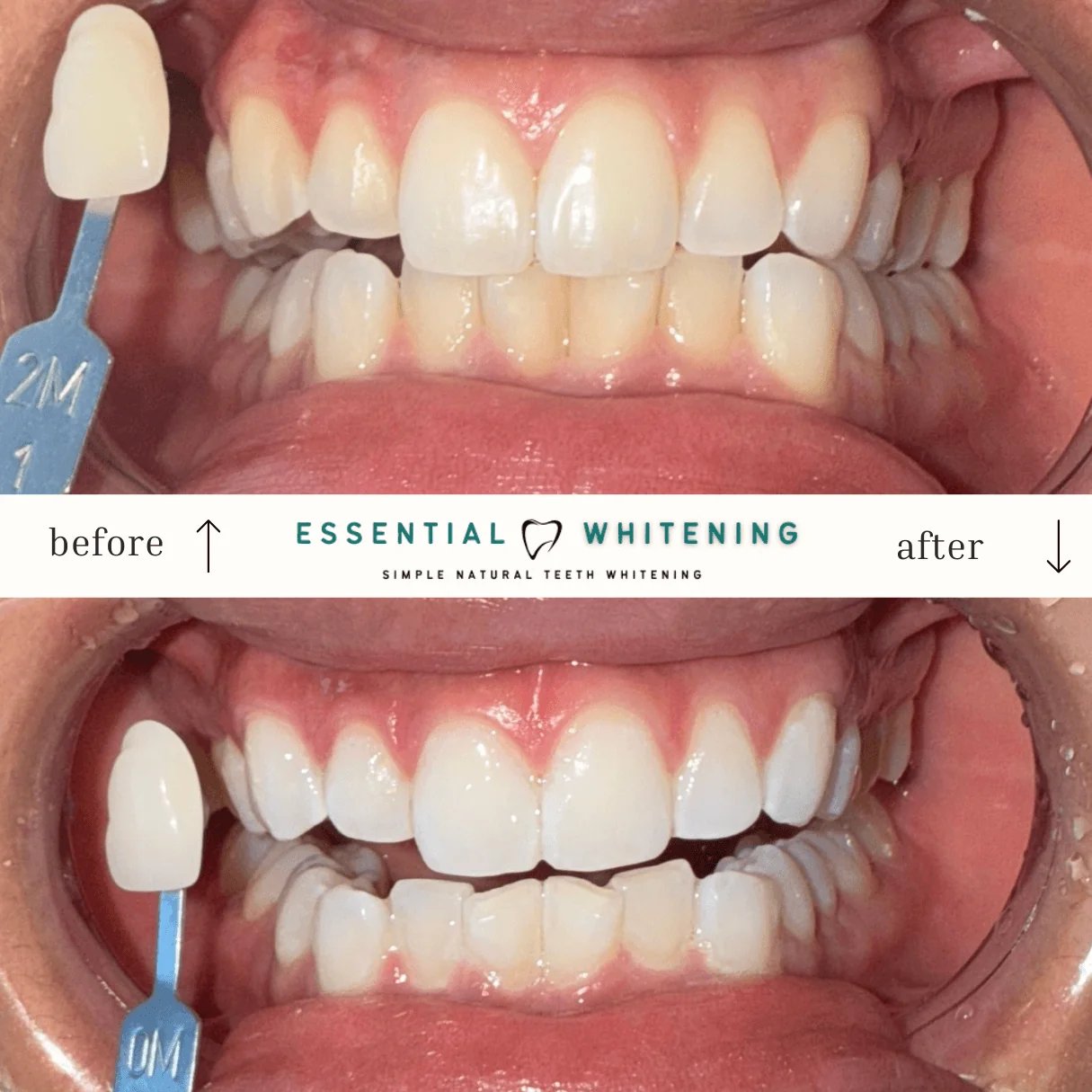 Essential Whitening before and after result 9