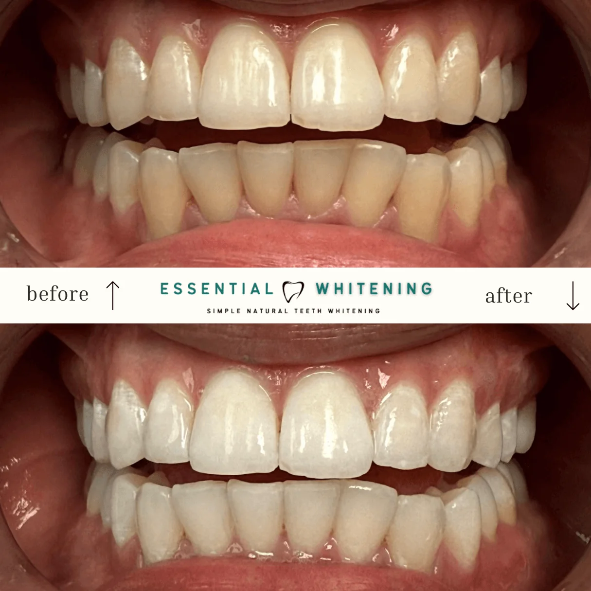 Essential Whitening before and after result 8
