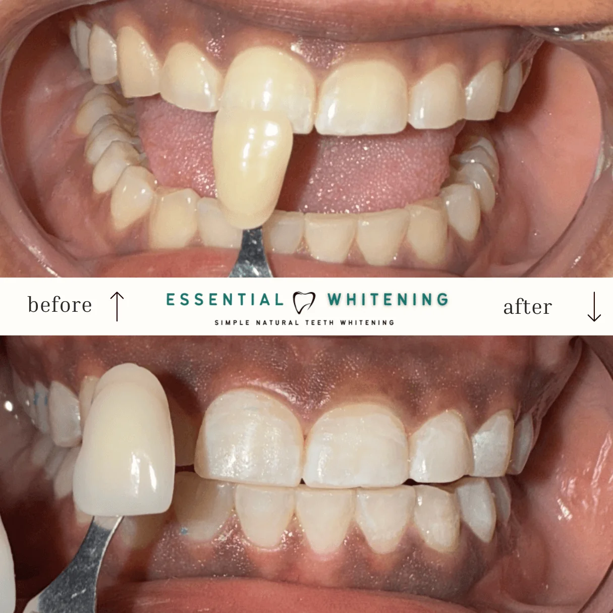 Essential Whitening before and after result 7